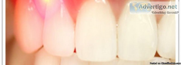 Laser Dentistry Services in Toronto