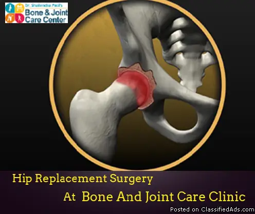 Hip Replacement Surgery in Thane