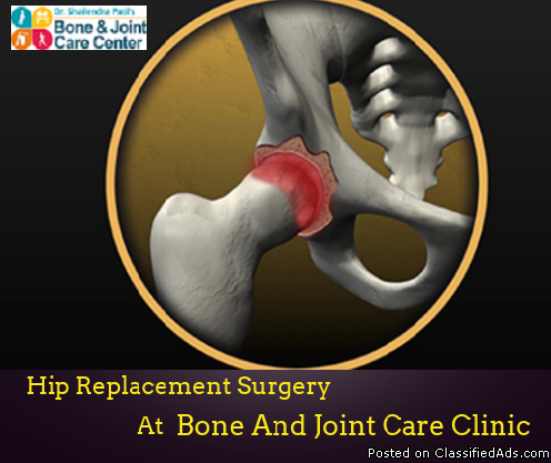 Hip Replacement Surgery in Thane