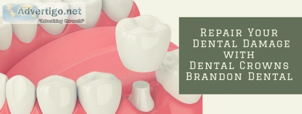Smile with Perfect Dental Crown Lithia