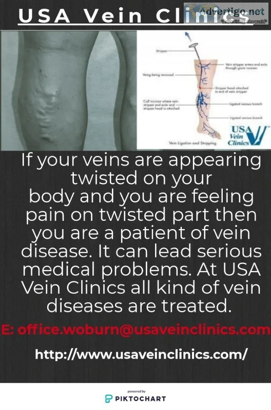 USA Vein Clinics
