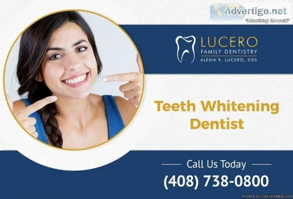 Best Teeth Whitening Dentist in Sunnyvale CA  Lucero DDS