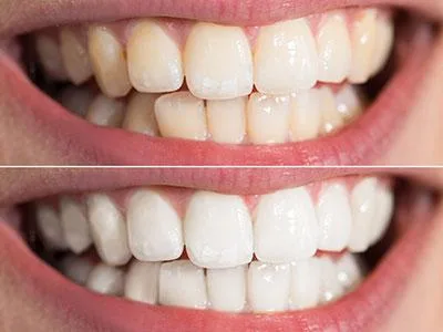 professional dental clinic in South Delhi  Common Dental problem