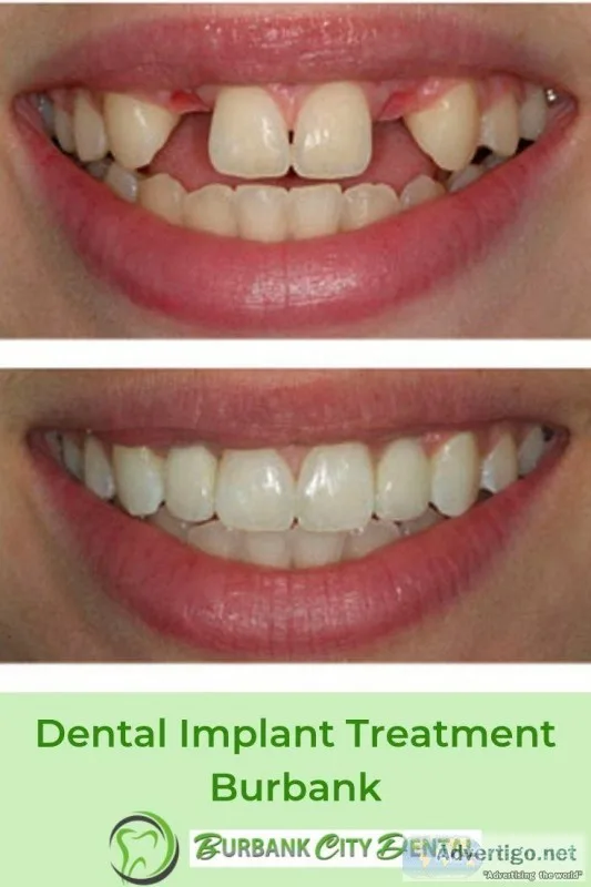 Best Dentists for All Dental Services in Burbank