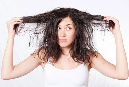 homeopathy hair loss treatment in hyderabad