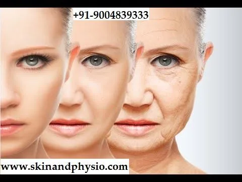 TREATMENT FOR WRINKLES