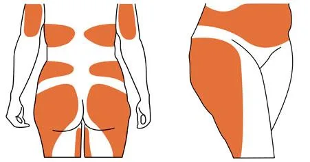 Liposuction Surgery Cost In Delhi Best Liposuction Surgeon In De