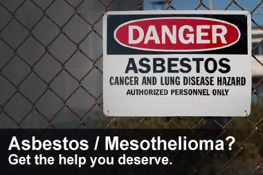 Tucson Mesothelioma Treatment