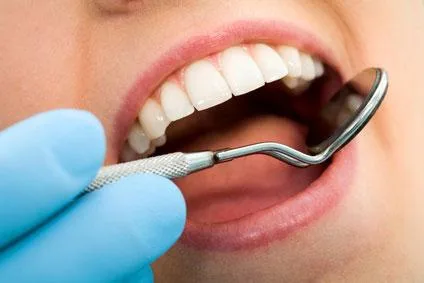 Dental Cleaning (regular and deep) X-rays sealants