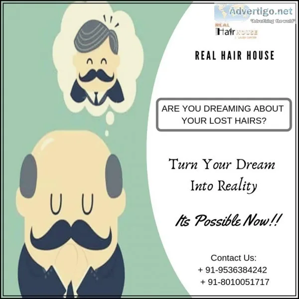 Hair Patch in Delhi