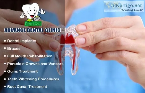 Root Canal in GTB Nagar