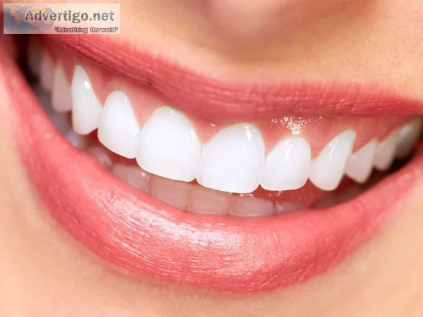 Cosmetic Dentistry Treatment in Hyderabad