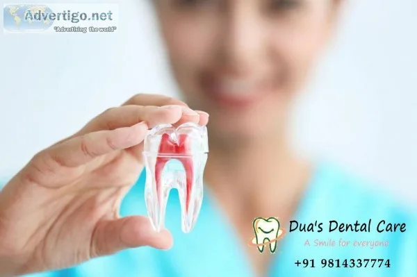 Root canal Treatment in Baltana