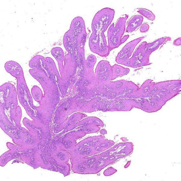 Interested in the Best Oral histology services in Delhi NCR Indi