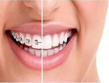 Top  100  dentist in  prahladnagar   Satellite Ahmedabad Dental 
