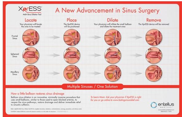 Best Rhinoplasty Surgeon in Los Angeles  Calwestent.com