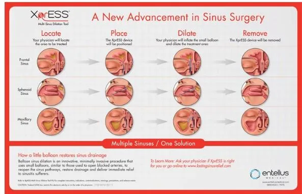 Best Rhinoplasty Surgeon in Los Angeles  Calwestent.com
