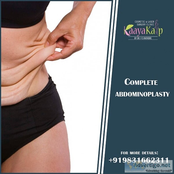 Abdominoplasty in Kolkata