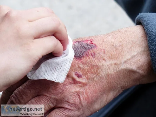 Non-Healing Wounds Treatment