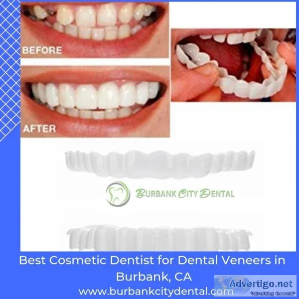 Best Porcelain Dental Veneers Burbank California