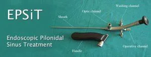 Endoscopic Pilonidal Sinus Treatment  EPSIT  Aum Clinics  921000