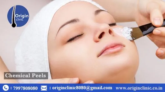 wart removal treatment