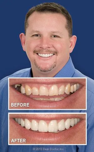 Dental Implants Waterloo  Eastbridge Dental Care