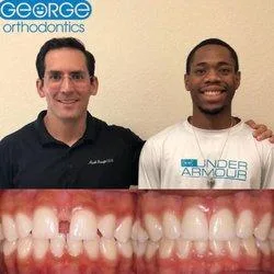 Braces in Colorado Springs