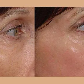 Arkansas Laser and Skin Care