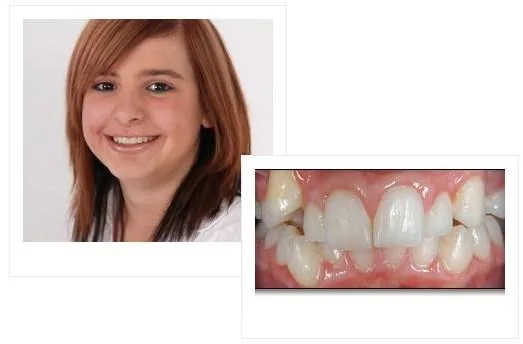 Best Cosmetic and Family Dentist in Waterloo