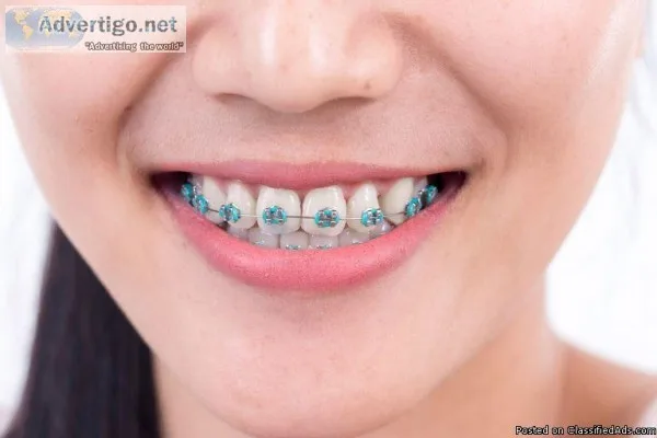 Best Dental in Vijay Nagar