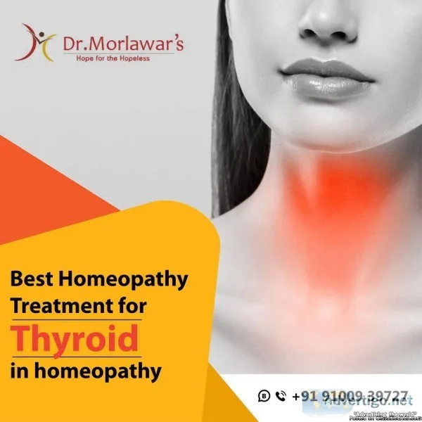 Thyroid Treatment in Homeopathy  Homeopathic Medicine for Hypert