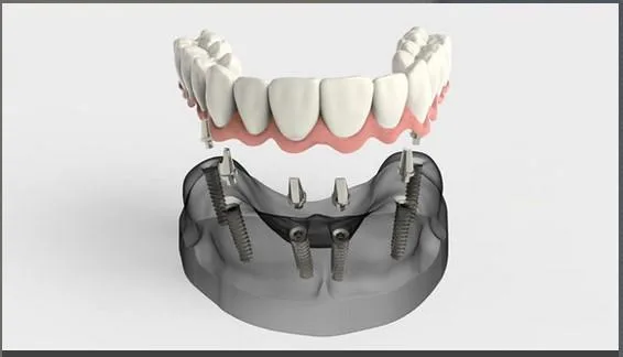 Find the Best Dentist in Lewiston and Auburn