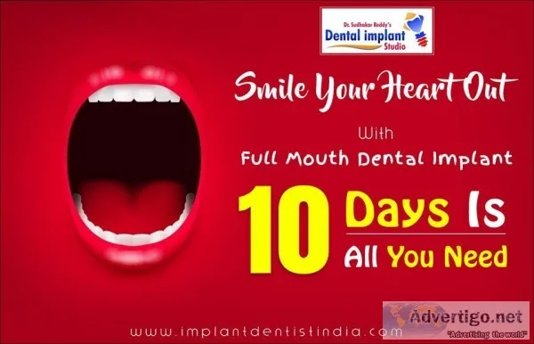 Get Full Mouth Dental Implants Fixed  Within 10 Days Dental Impl