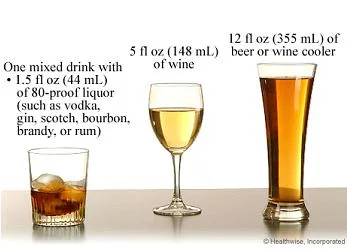 DUI Lawyer For Criminal Charges