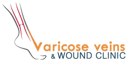 Best varicose veins treatments with SCLEROTHERAPY