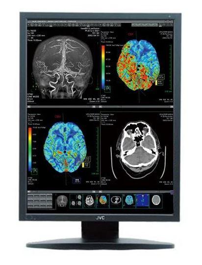 New JVC 2MP CCL258i2 Color Medical Diagnostic Monitor