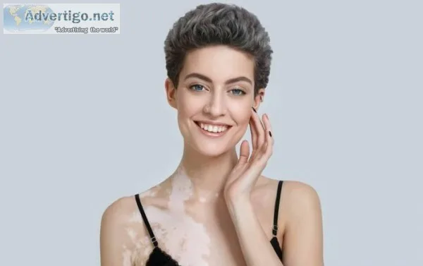 Cost of vitiligo treatment in Ludhiana
