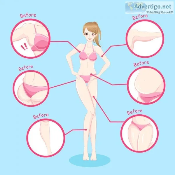 Get Full Body Liposuction In Korea