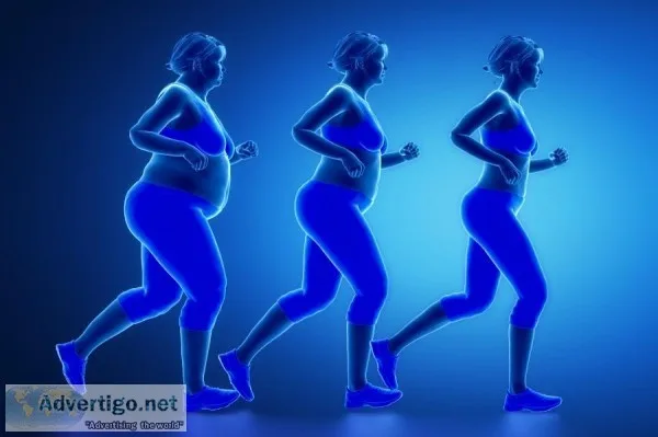 Weight Loss Centre in Delhi-Dr Anjana Kalia