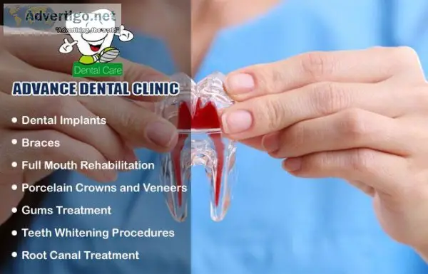 Best Dental Clinic in Vijay Nagar