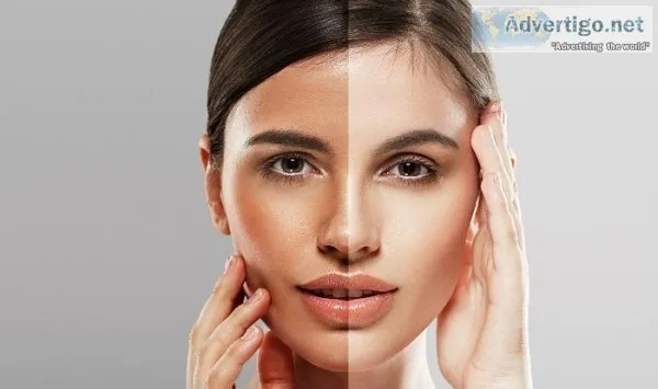 Berkowits Skin Brightening Treatment