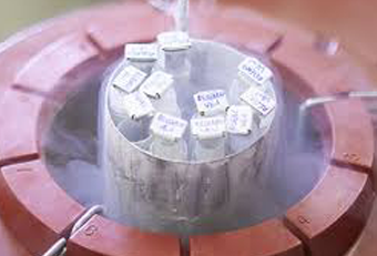Sperm Freezing in Hyderabad