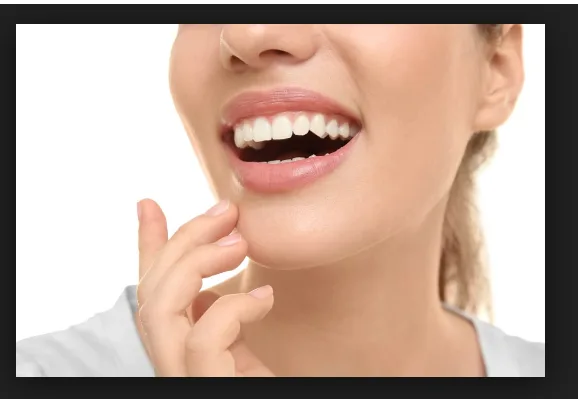 Are you looking for best Invisalign in Broadstone