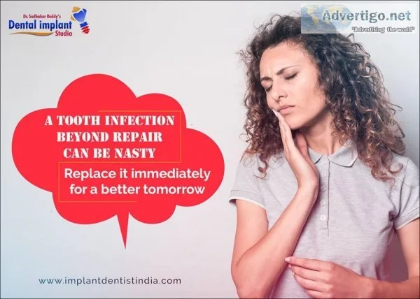 Don t Compromise Your Looks After Tooth Removal Replace It Right