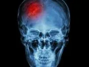 Dr. Ranga Chelva Krishna  Strokeclinicsofnyc.c om