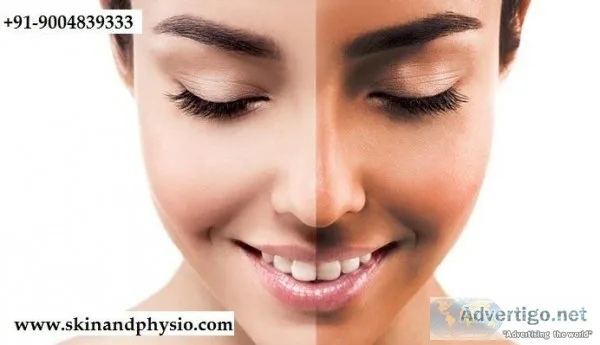 BEST TREATMENT FOR ANTI-TAN