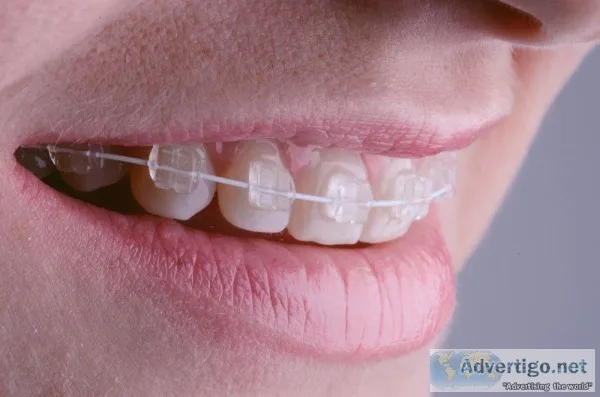Best Dental Services in Mumbai at Dentcure