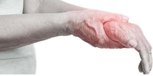 Heal arthritis pain through Superficial heat