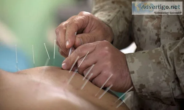 Acupuncture Near Me